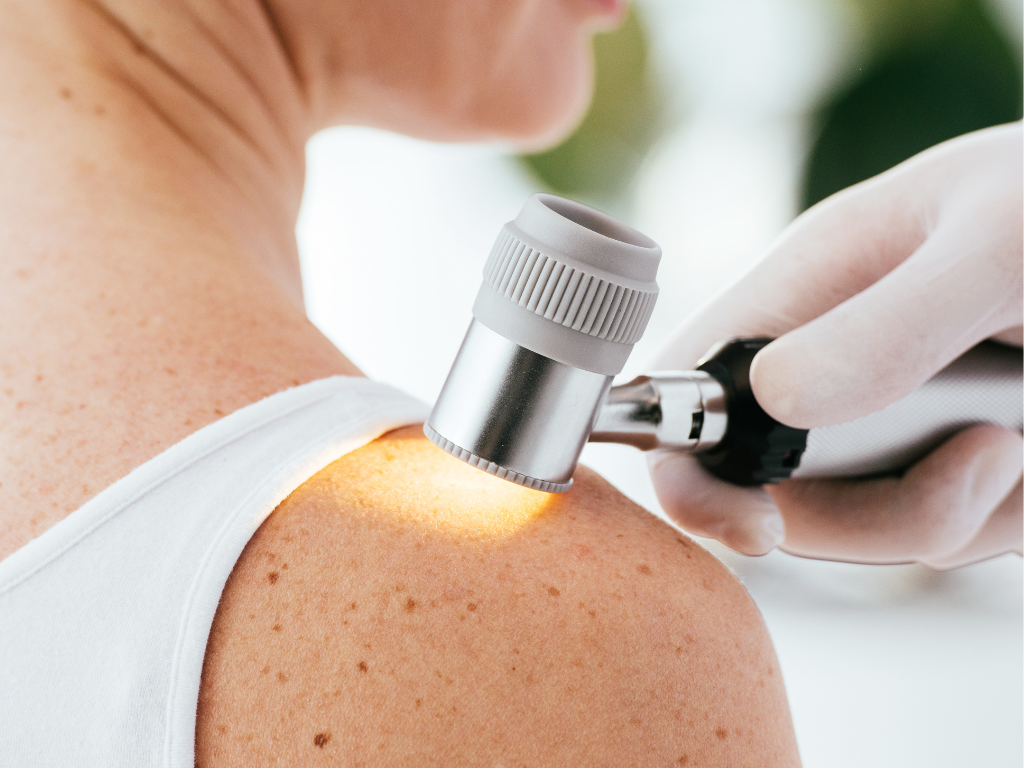 utilisation Dermatoscope