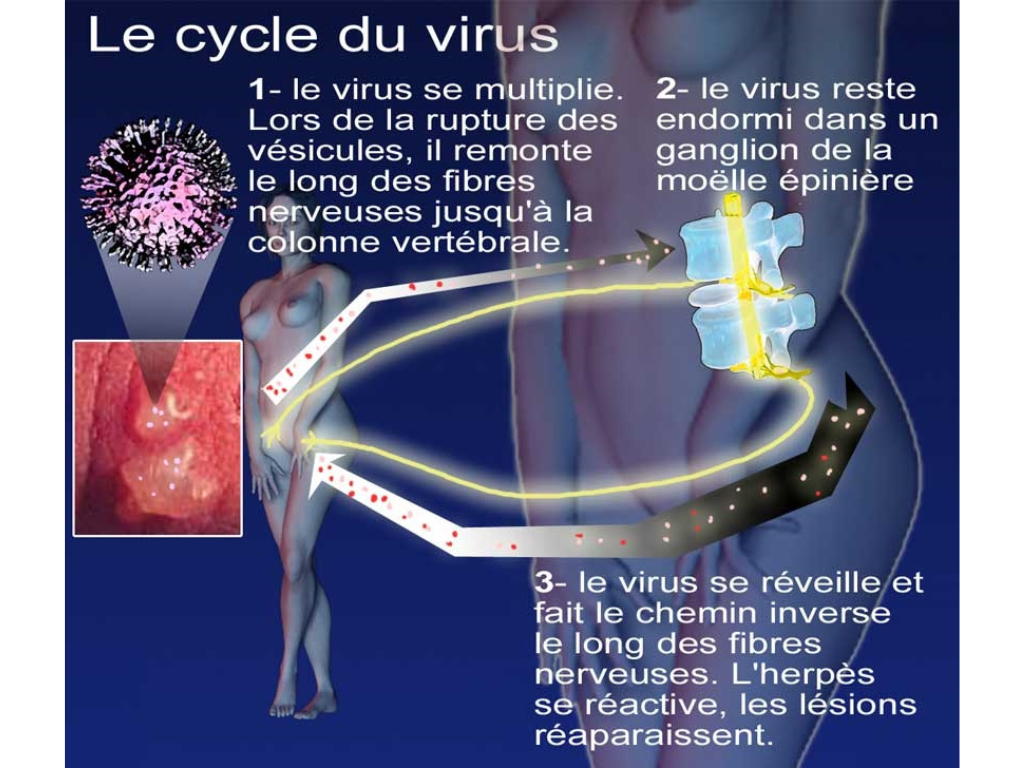 Herpès génital cycle