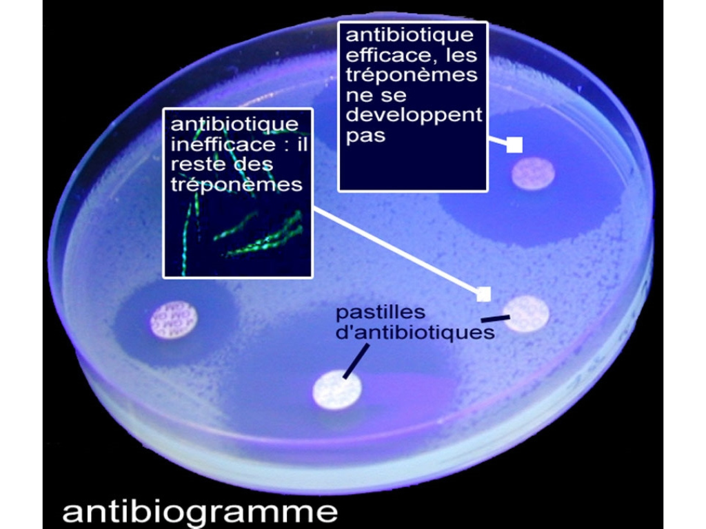 antibiogramme