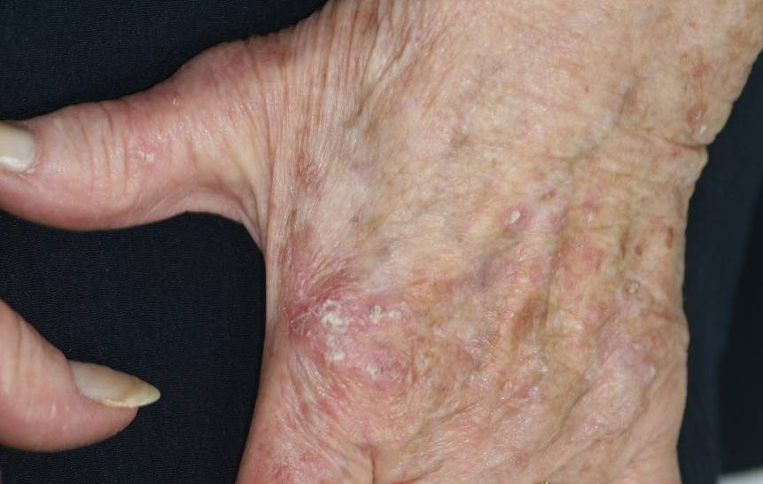 Avec une prise en charge étalée dans le temps