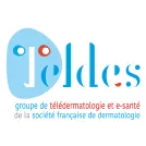 Teldes 