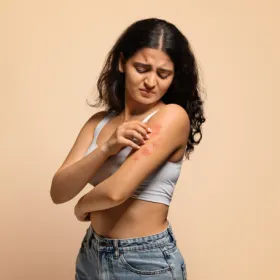 Dermatite atopique photo