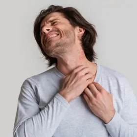 Eczéma de contact EXAMEN