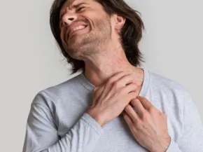 Eczéma de contact EXAMEN