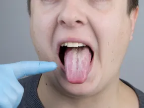 Langue géographique 