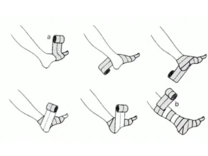 compression 