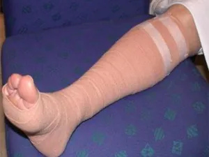 bandes élastiques