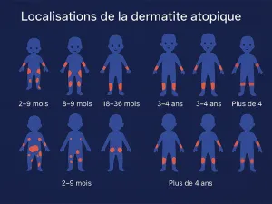 Des localisations typiques 