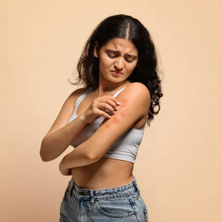 Dermatite atopique photo