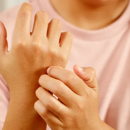 le prurit et le prurigo