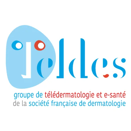 Teldes 