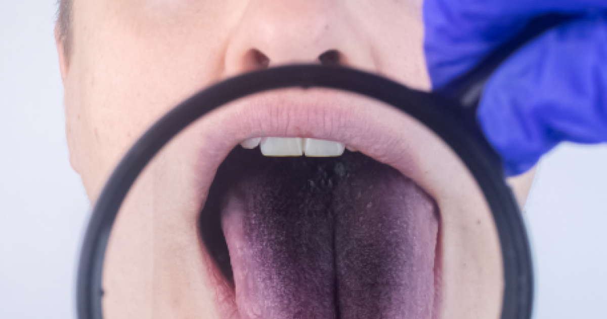 elfbar nachfll pod luft aus Vapotech